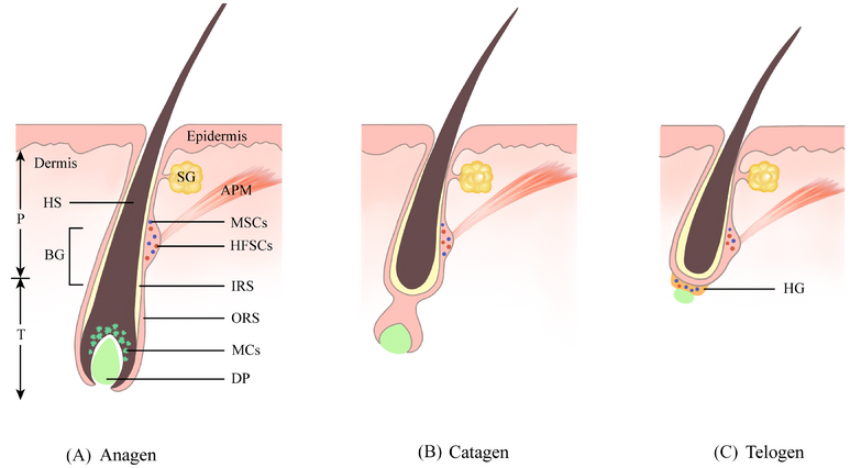 [Illustration of a hair follicle showing melanocytes producing melanin]